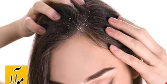 فرق شوره و پوسته سر در چیست؟
